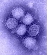 Virus Grppe A H1N1_influenza_virus.jpg